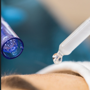 Microneedling